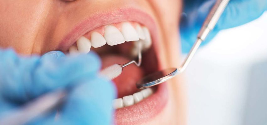 Why You Should Avoid Root Canals Like The Plague David Howard